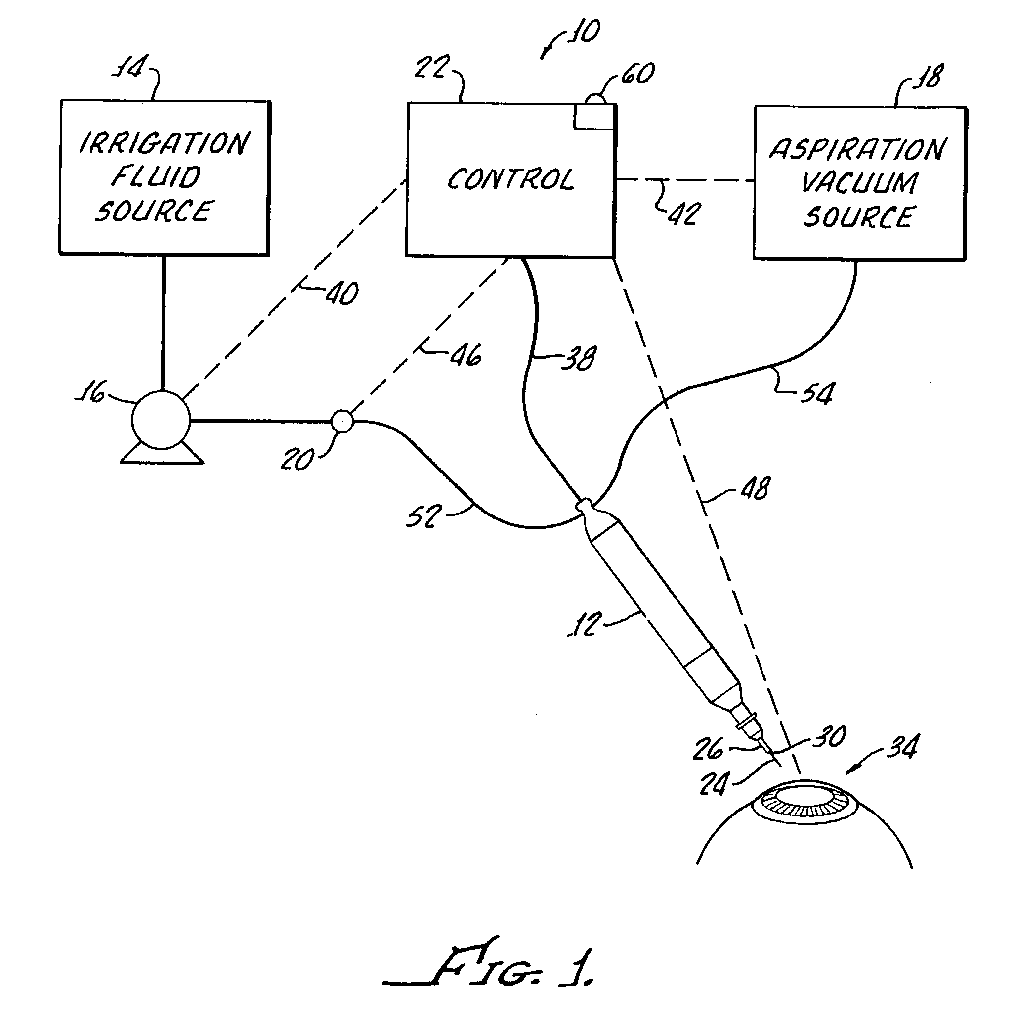 Method for controlling fluid flow to and from an eye during ophthalmic surgery