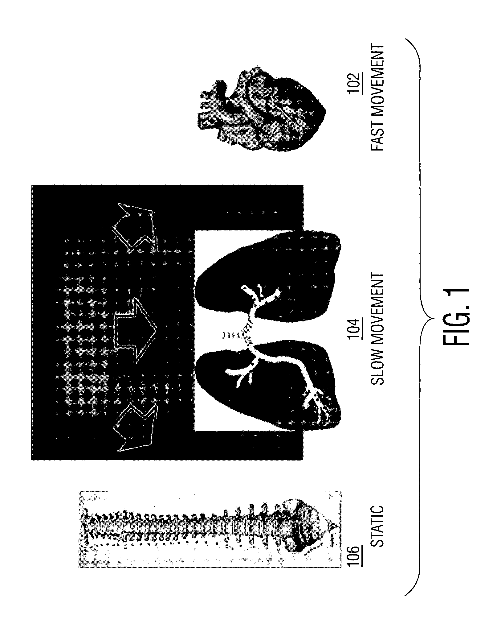 System and Method For Coronary Digital Subtraction Angiography