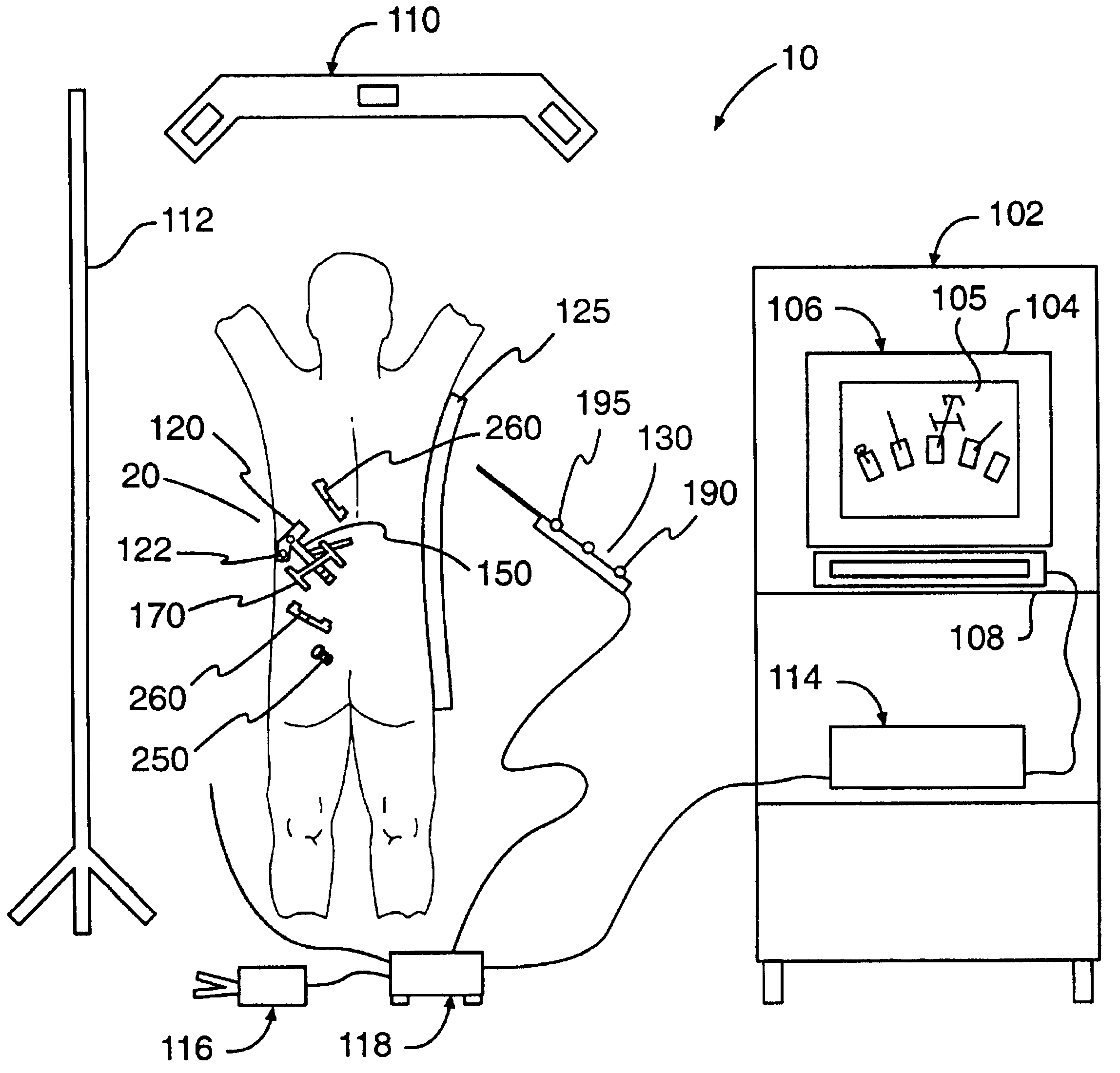 Percutaneous registration apparatus and method for use in computer-assisted surgical navigation
