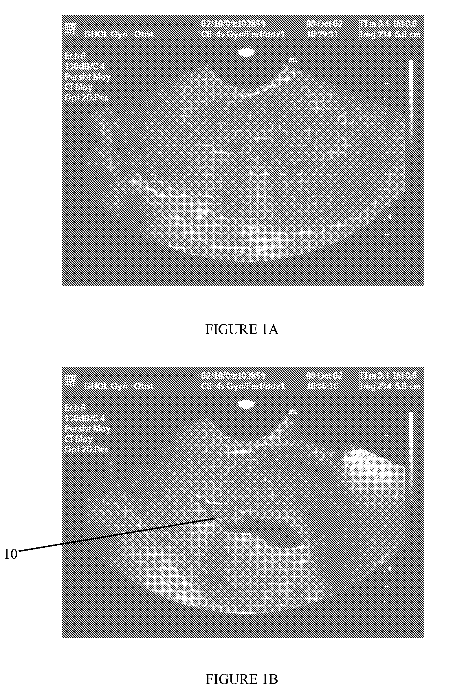 Medium for contrast enhancement or convenience for ultrasonic, endoscopic, and other medical examinations