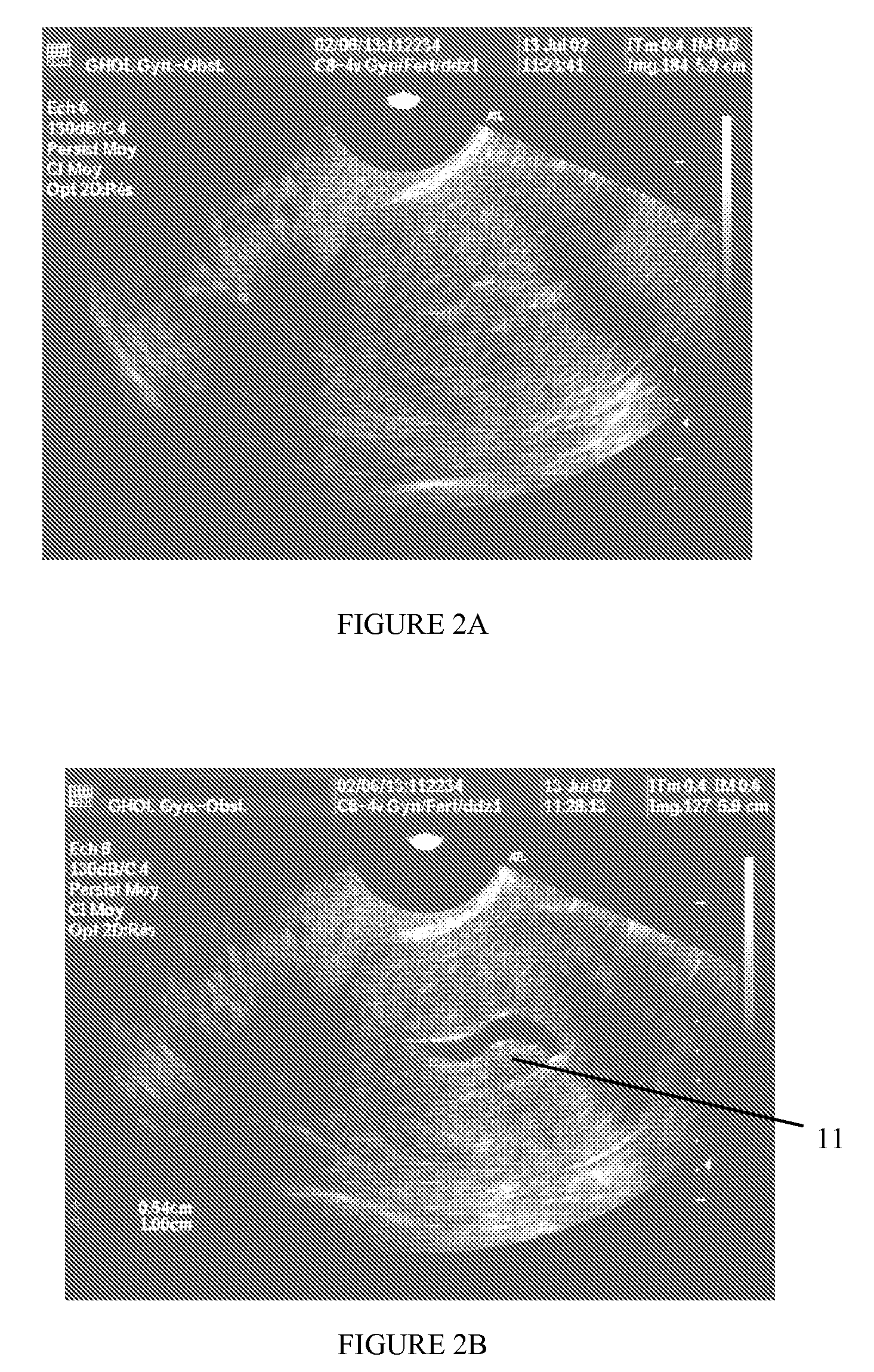 Medium for contrast enhancement or convenience for ultrasonic, endoscopic, and other medical examinations