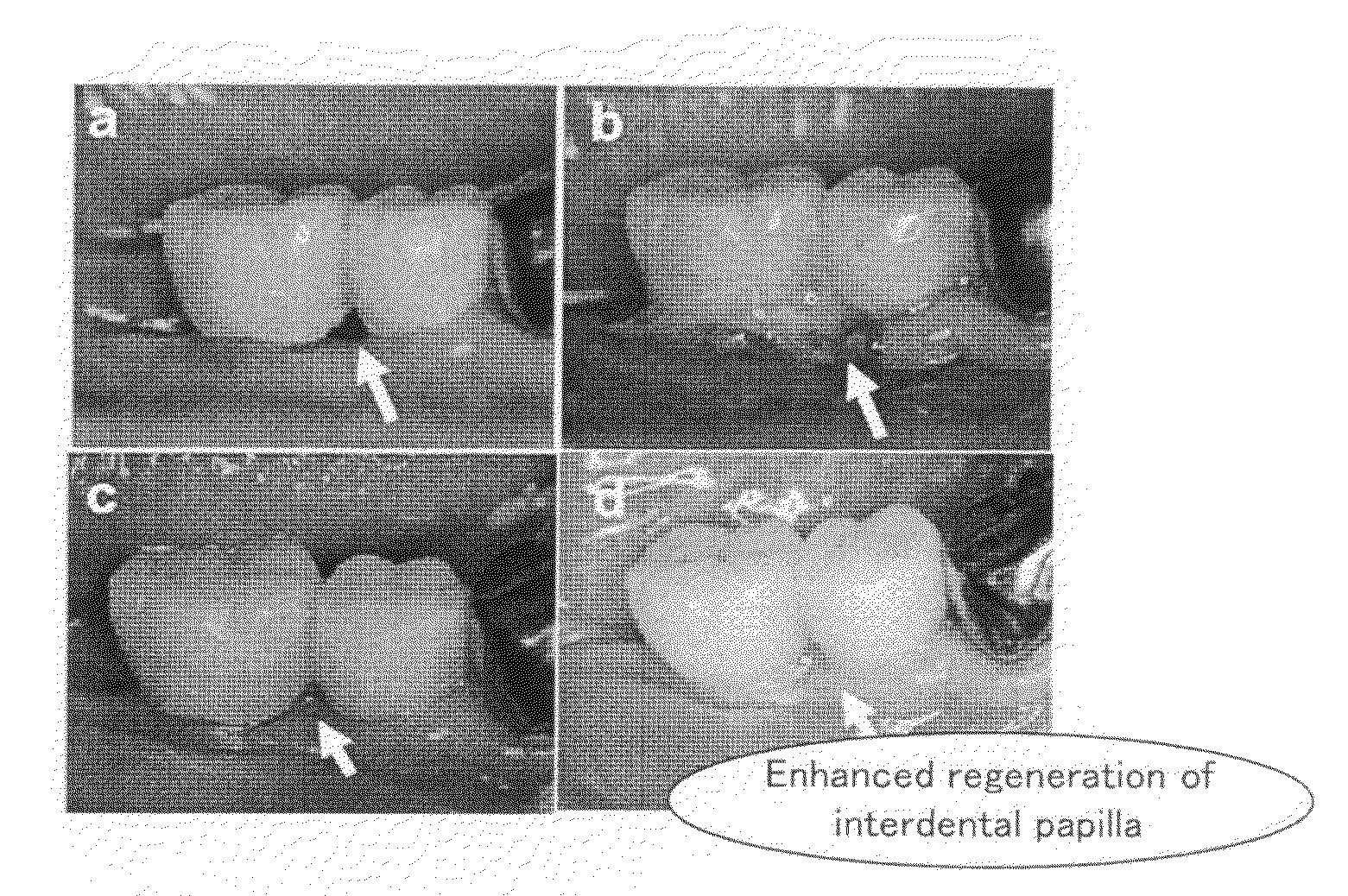 Composition for Regeneration of Periodontal Soft Tissue and Method for Producing the Same