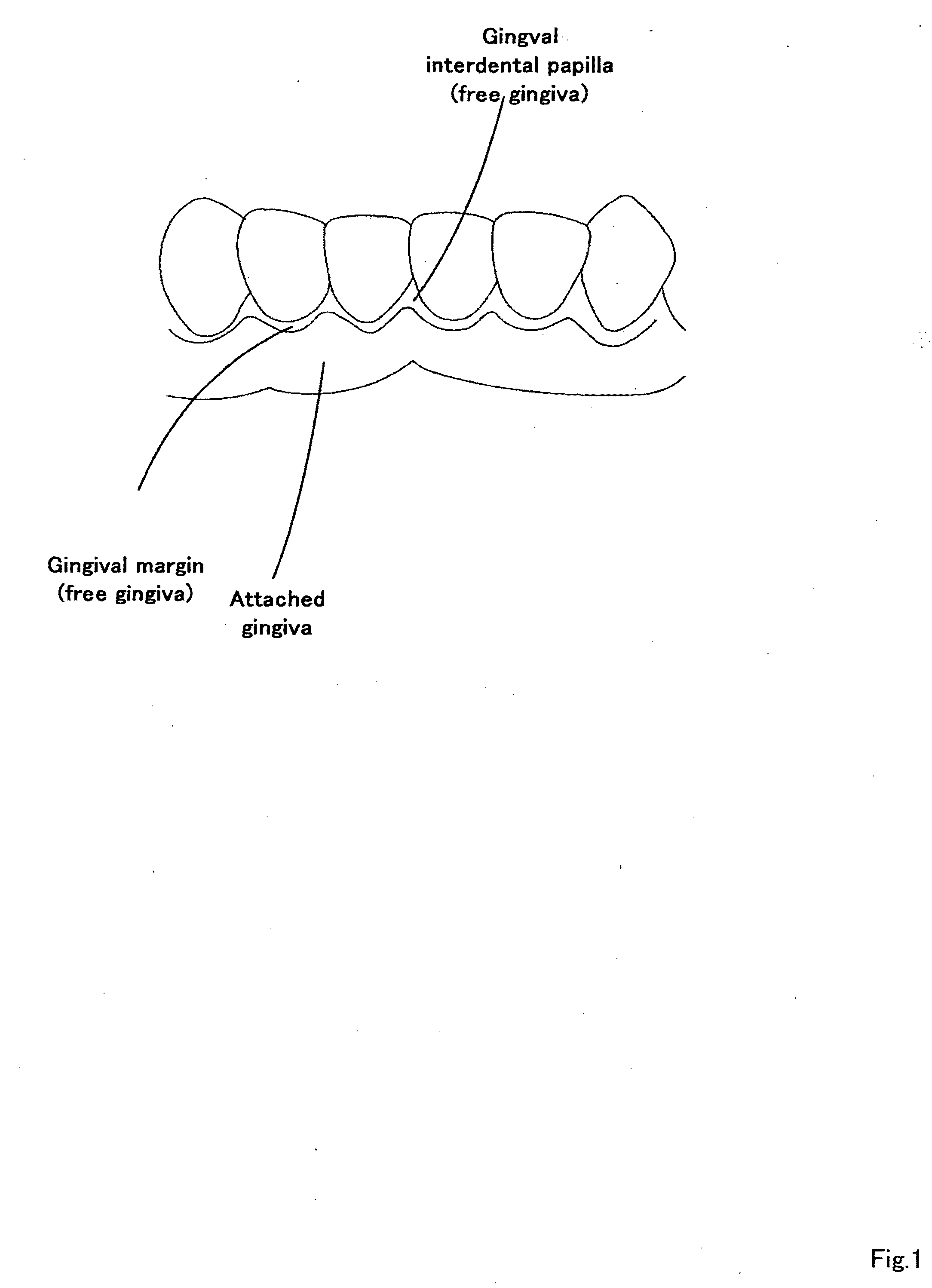 Composition for Regeneration of Periodontal Soft Tissue and Method for Producing the Same