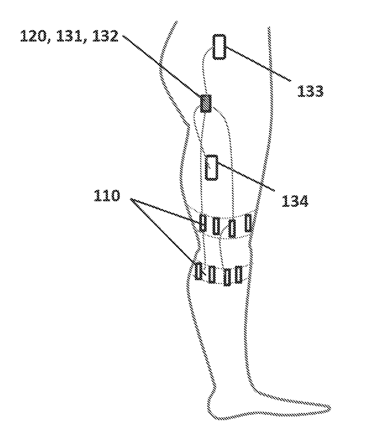 Device and methods for preventing knee sprain injuries
