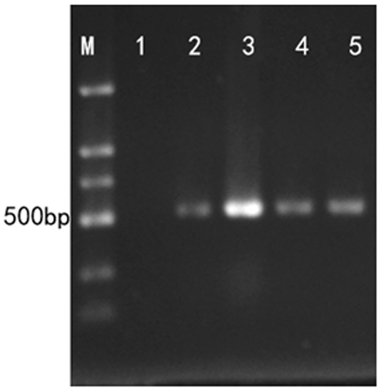 Virus particles for preventing and controlling wheat stem rot and method for controlling wheat stem rot