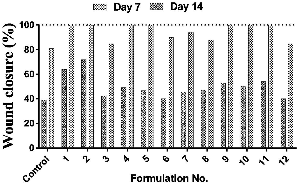 Epidermal growth factor liposome and preparation method thereof