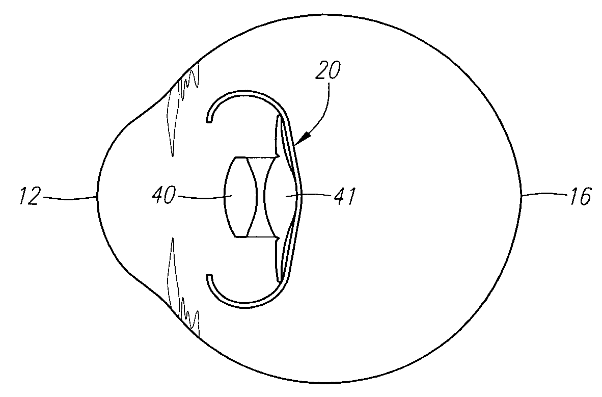 Multiocular Intraocular Lens Systems