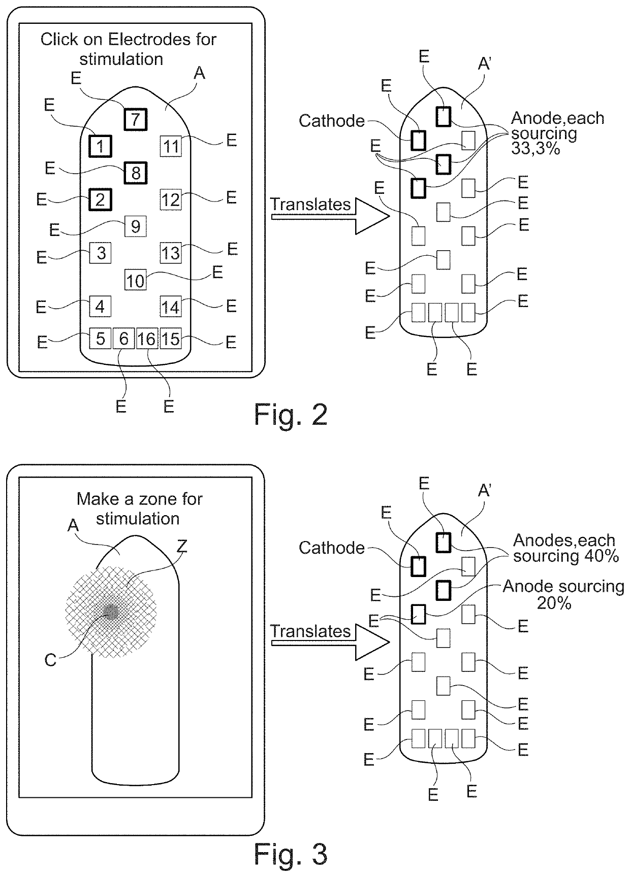 Planning and/or control system for a neuromodulation system