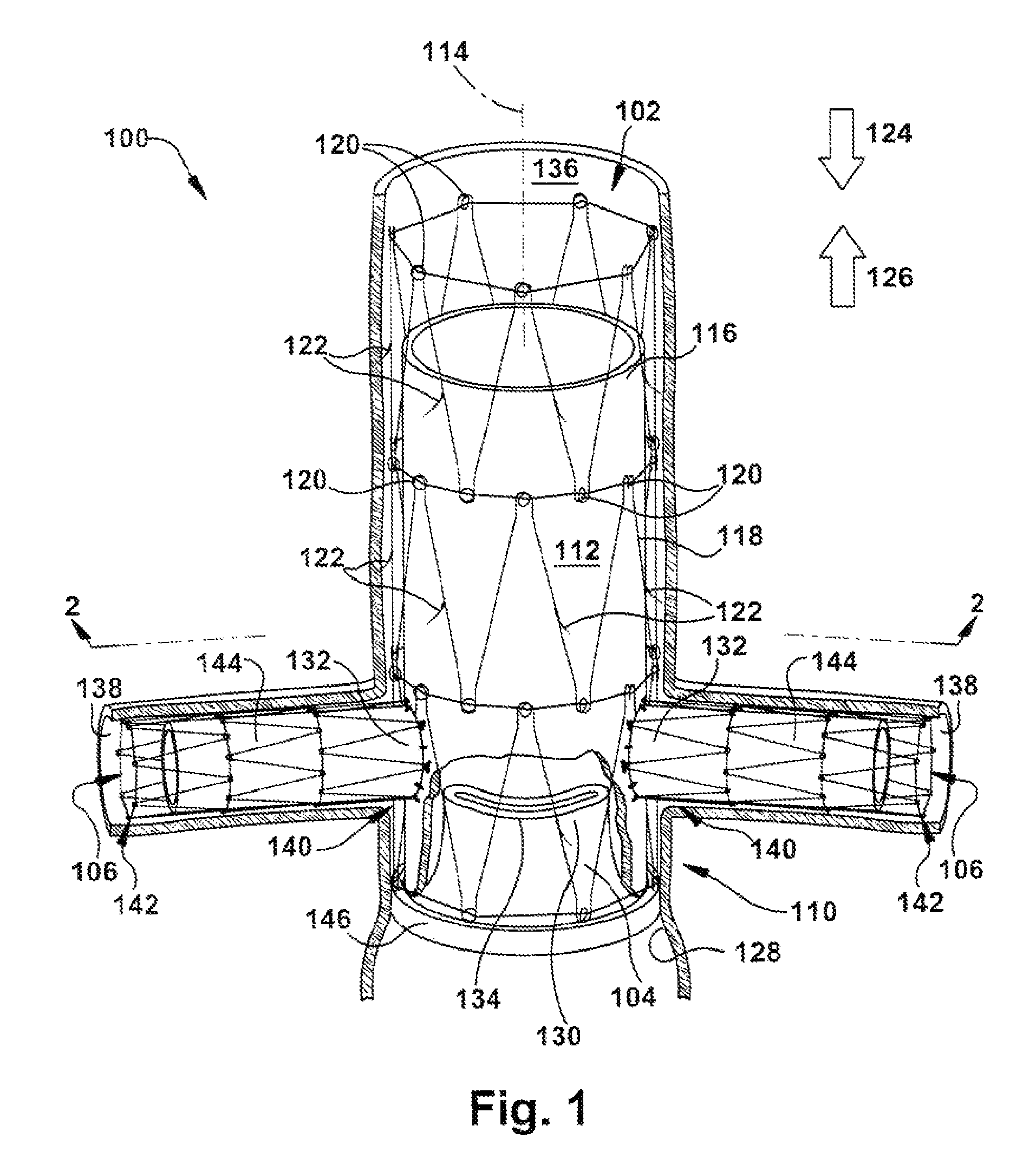 Apparatus for repairing the function of a native aortic valve