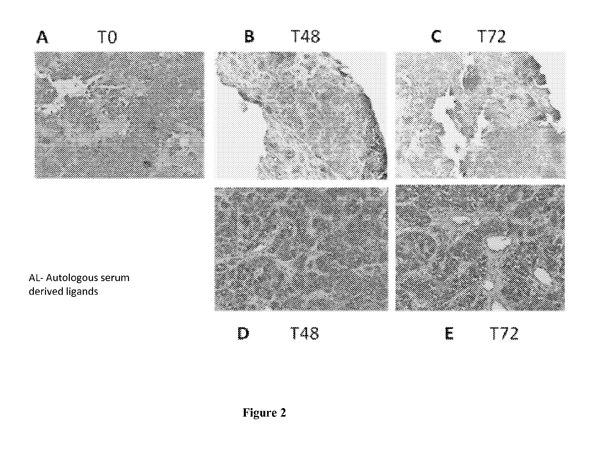 Ecm composition, tumor microenvironment platform and methods thereof