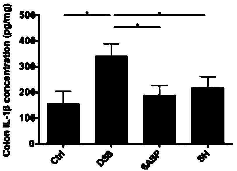 Composition for treating ulcerative colitis as well as granules and preparation method thereof