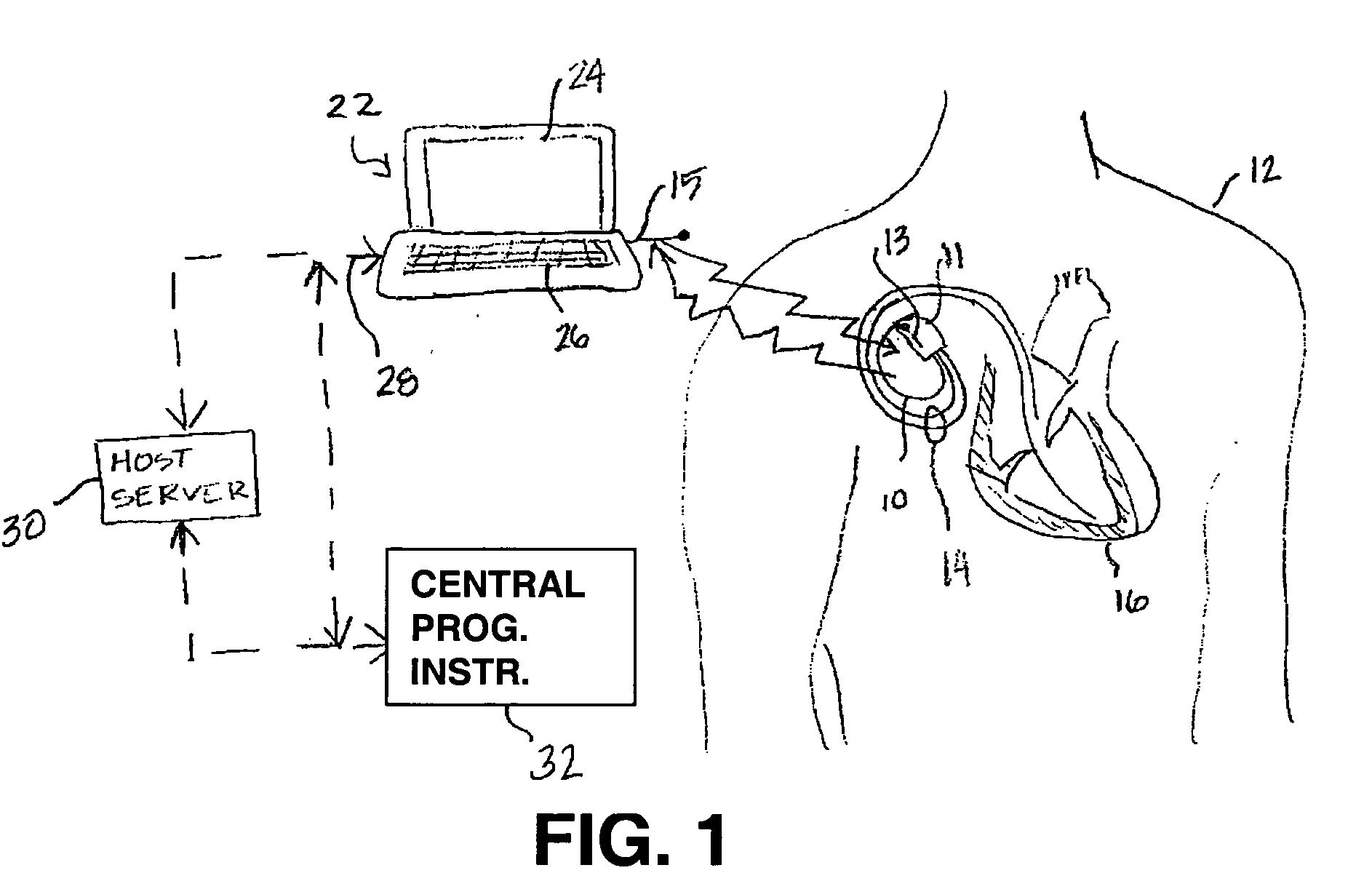 Conditional requirements for remote medical device programming