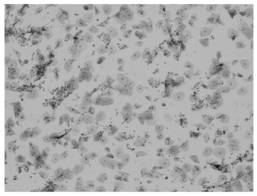 Sample density separation medium and cell separation method