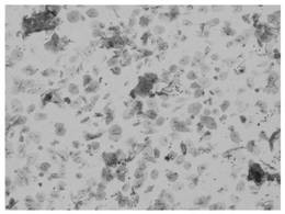 Sample density separation medium and cell separation method