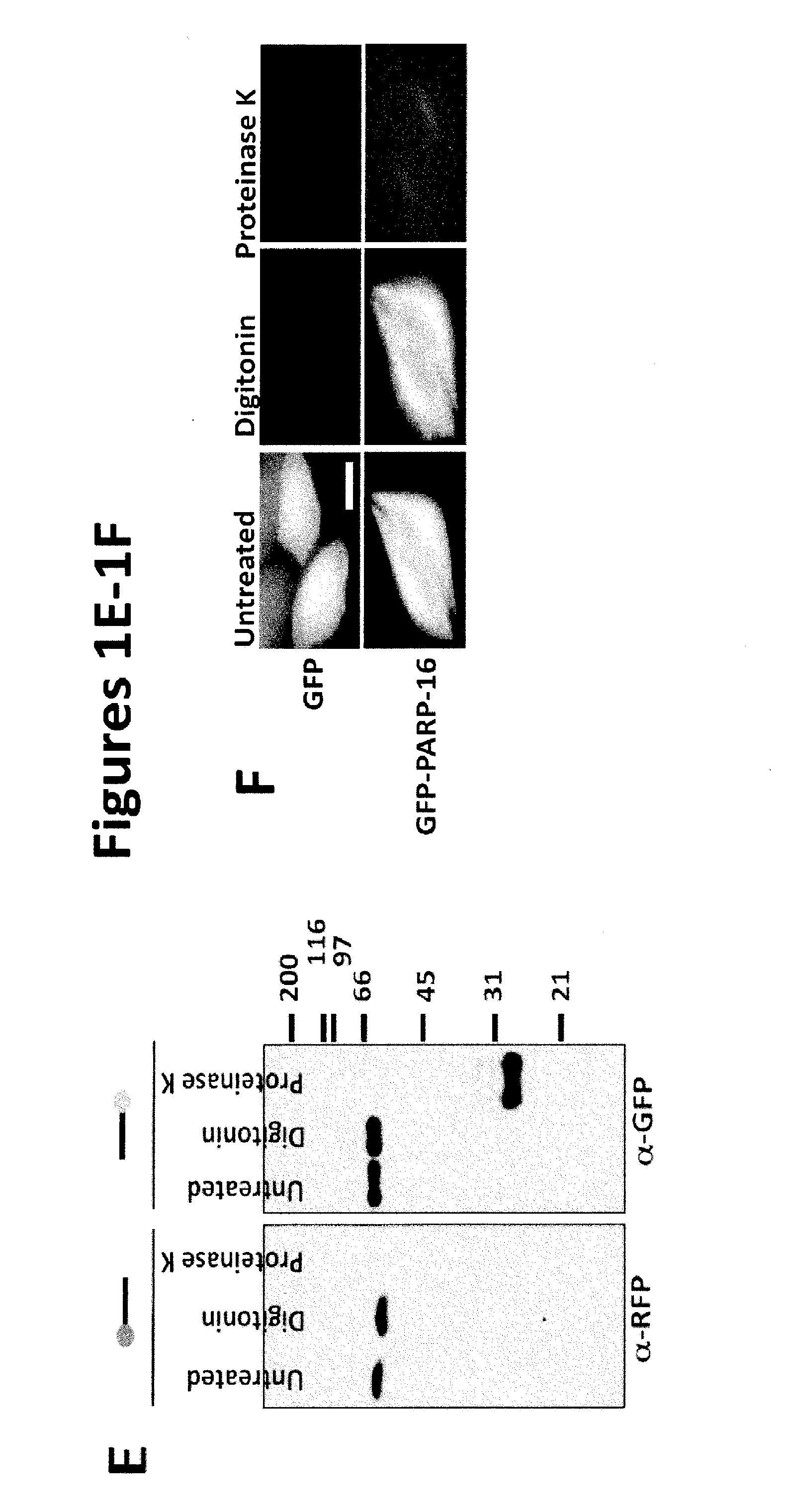 Methods of diagnosis and treatment of endoplasmic reticulum (ER) stress-related conditions