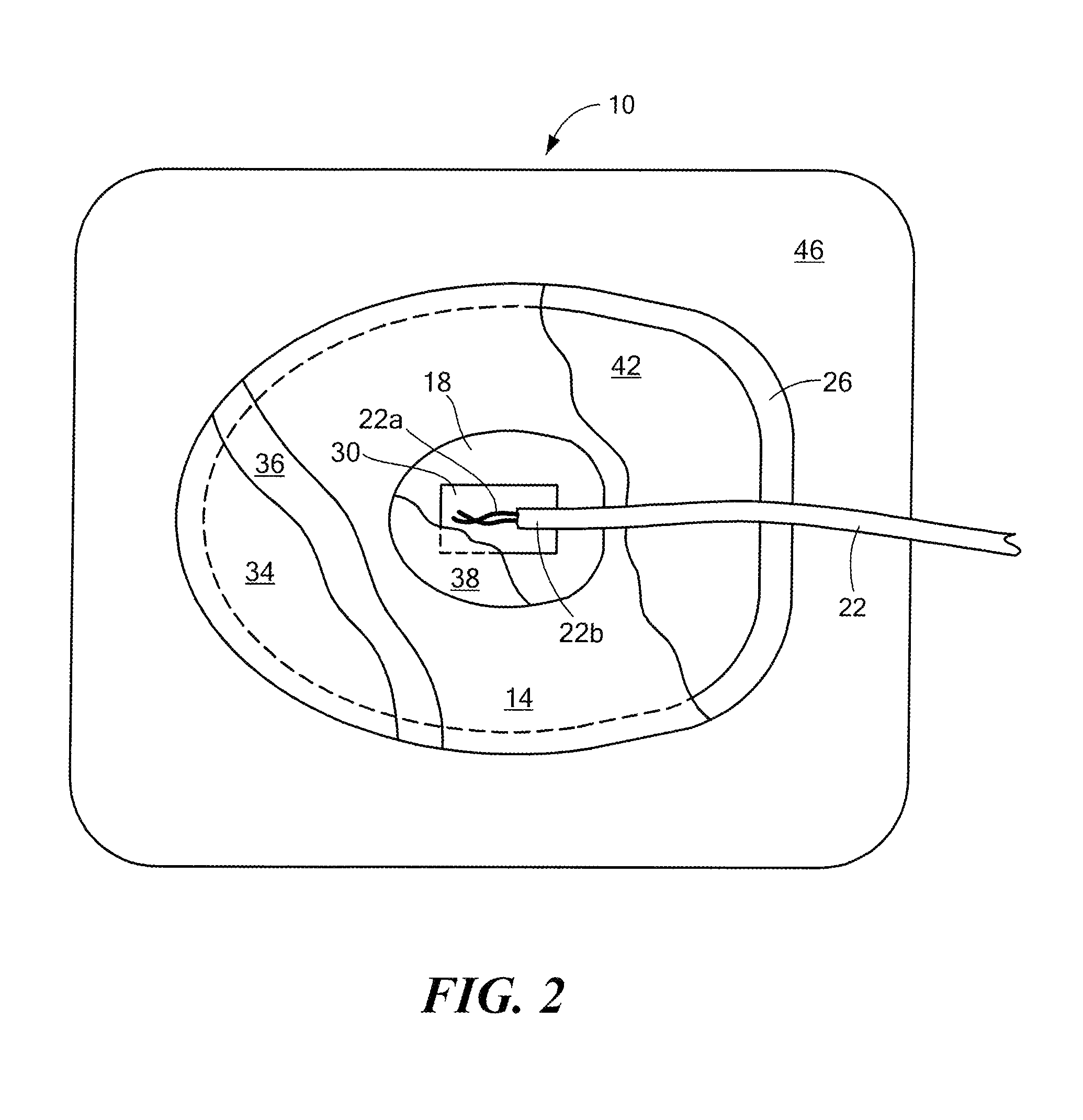 Apparatus and method for energy distribution in a medical electrode