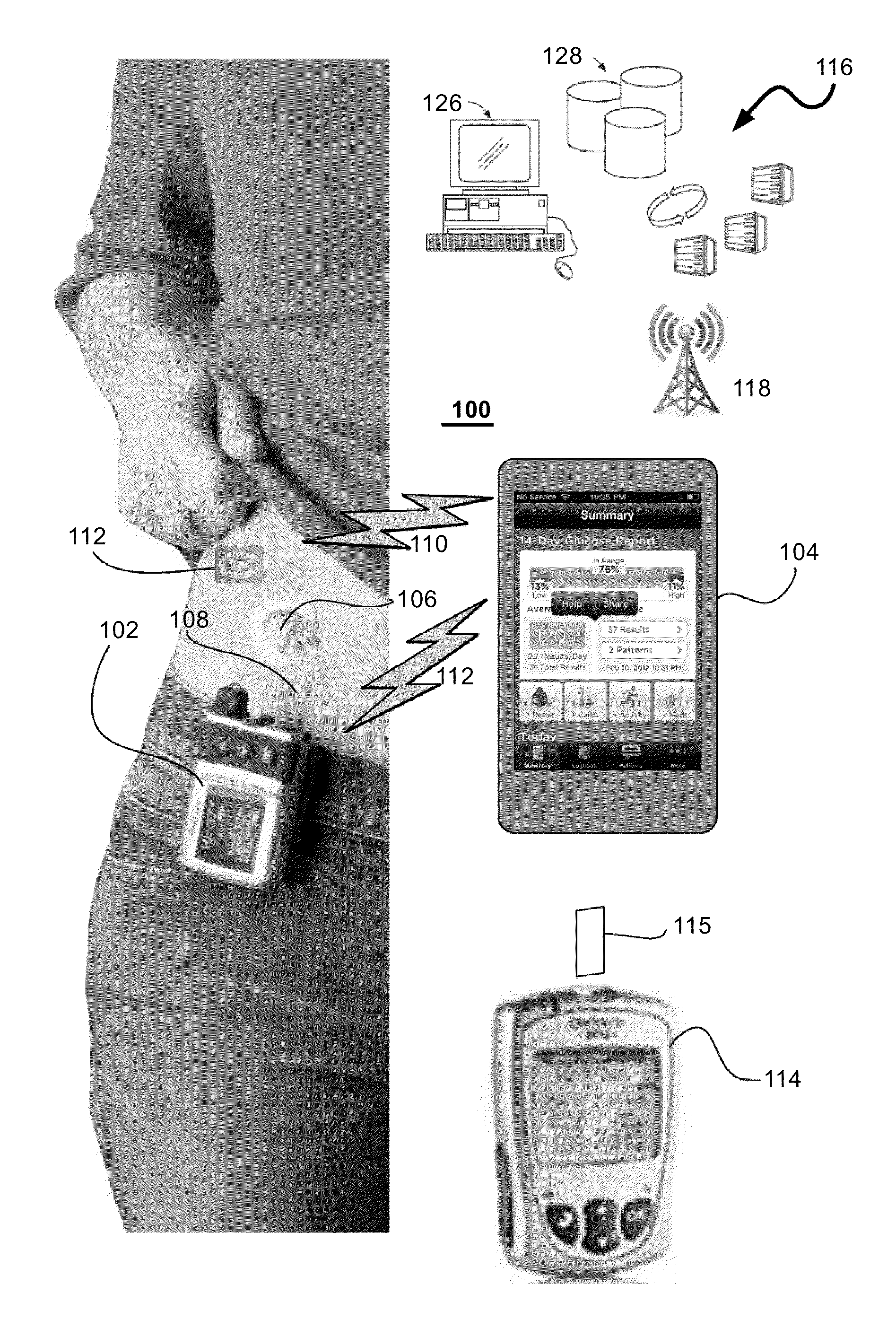 Method and System for Closed-Loop Control of an Artificial Pancreas