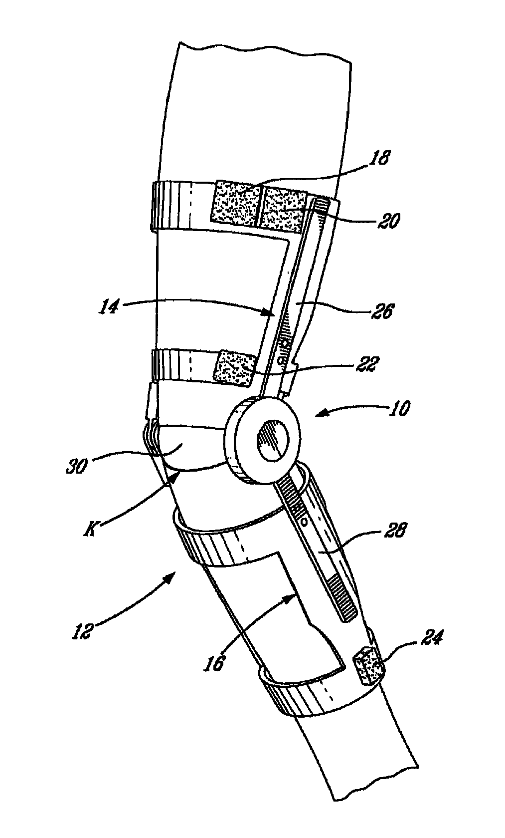 High torque active mechanism for orthotic and/or prosthetic devices