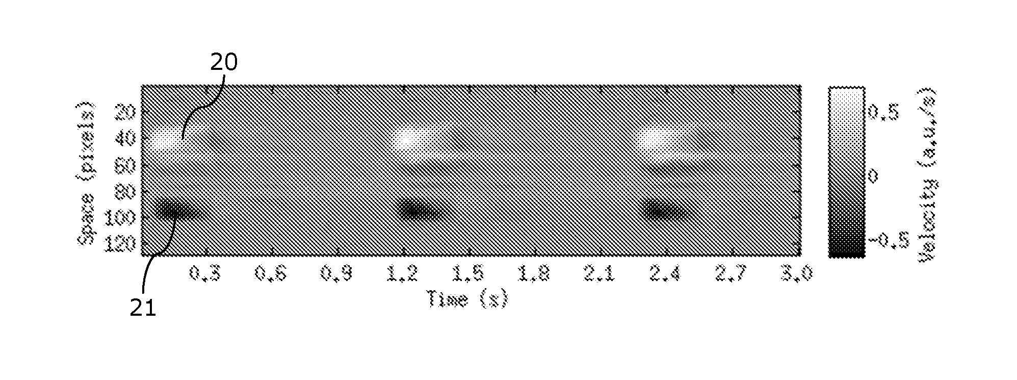 Method for determining a personalized cardiac model using a magnetic resonance imaging sequence