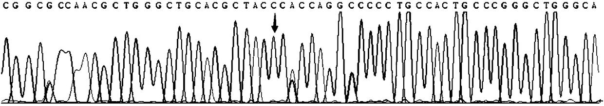 Individualized medication gene testing reagent kit for beta-receptor blocker