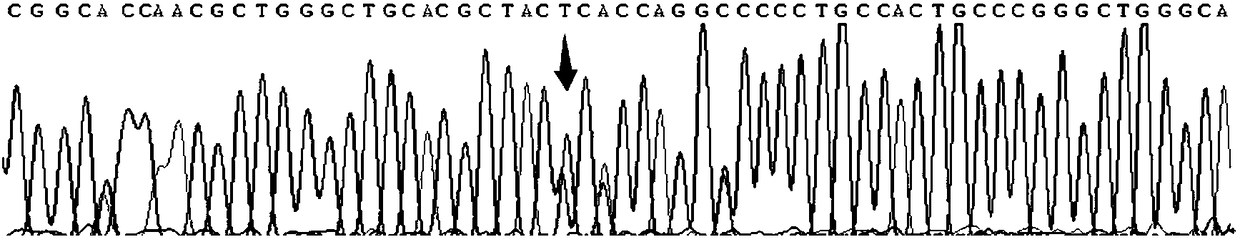 Individualized medication gene testing reagent kit for beta-receptor blocker