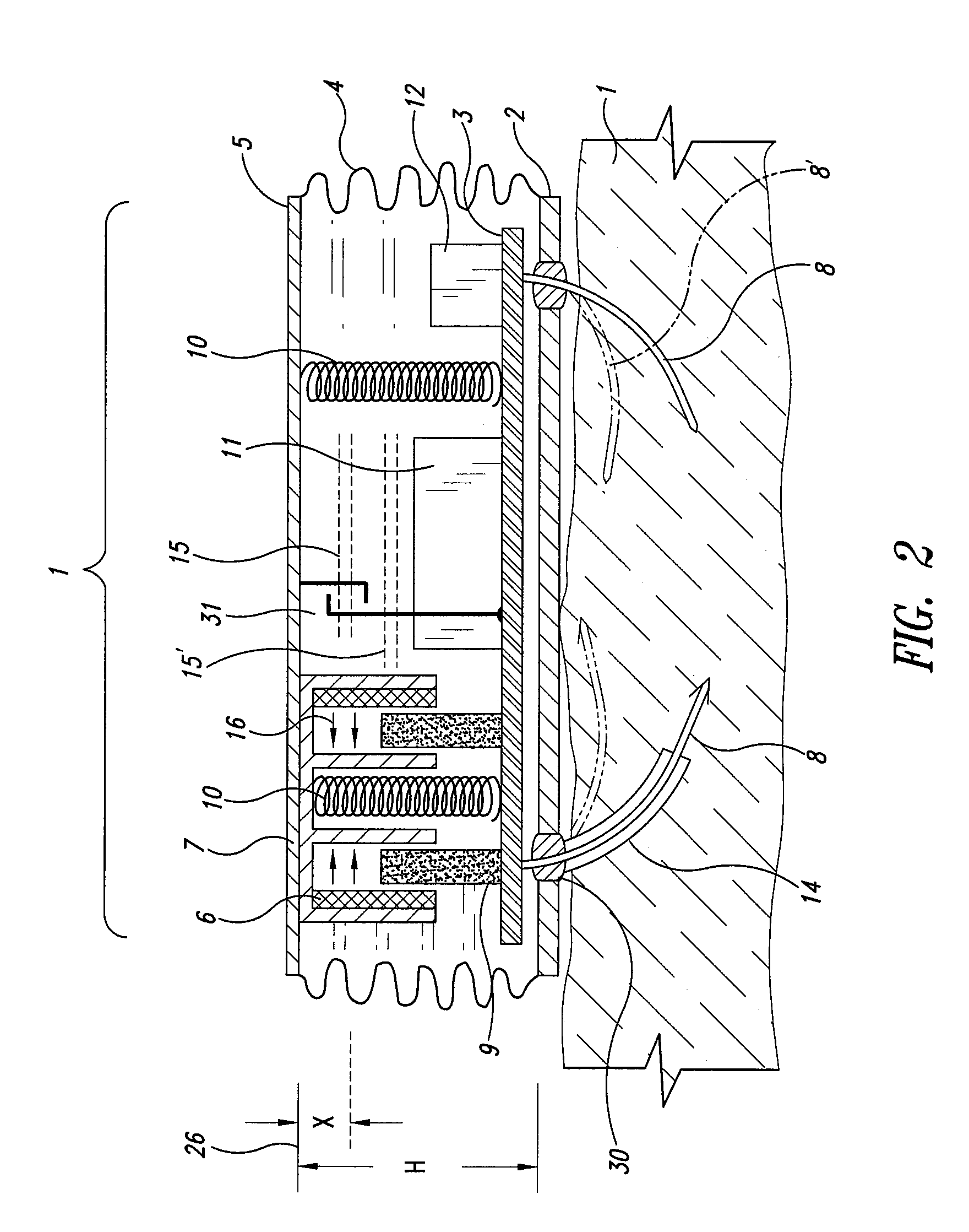 Self-powered leadless pacemaker