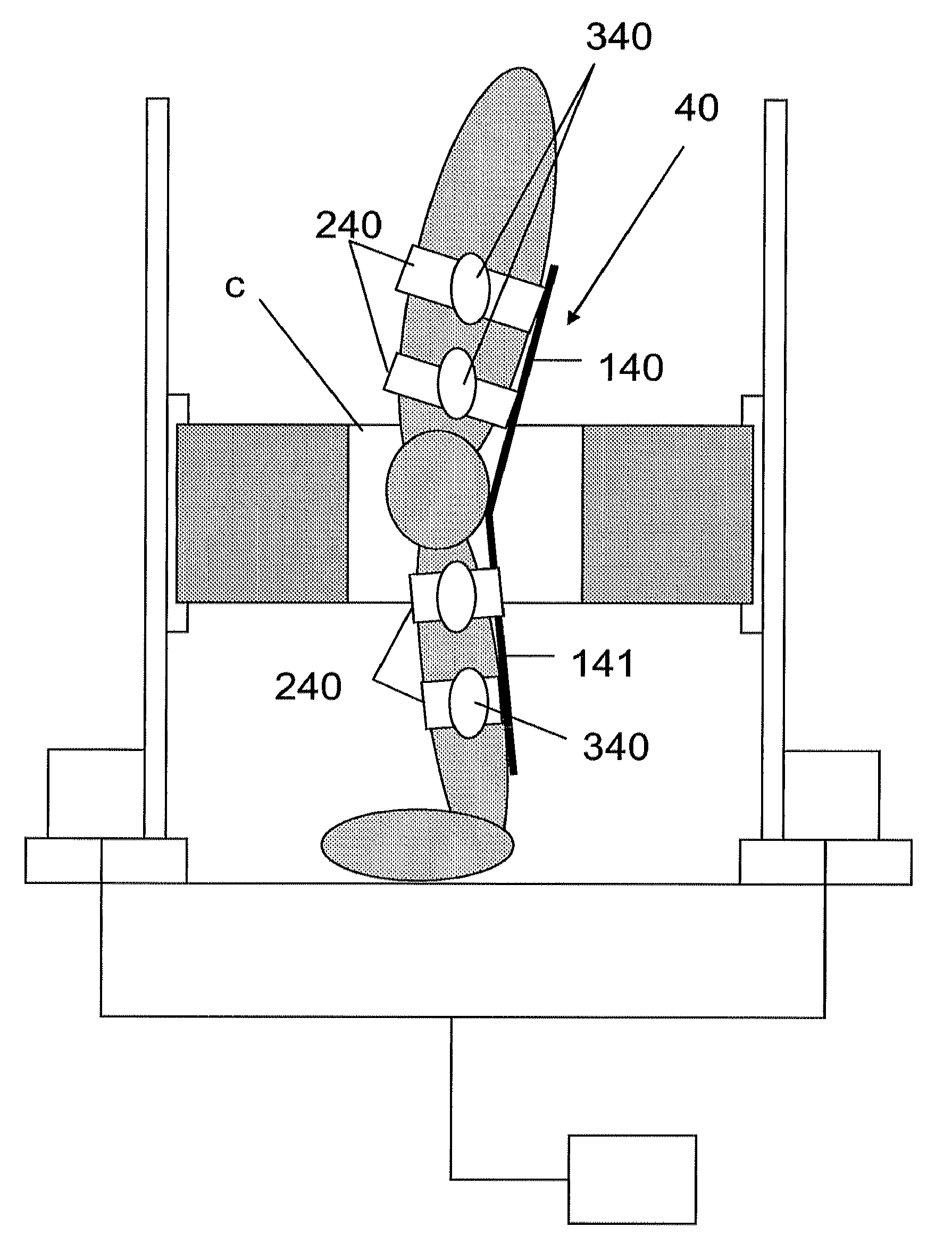 Apparatus for magnetic resonance imaging of patients with limbs, particularly lower limbs, under natural stress