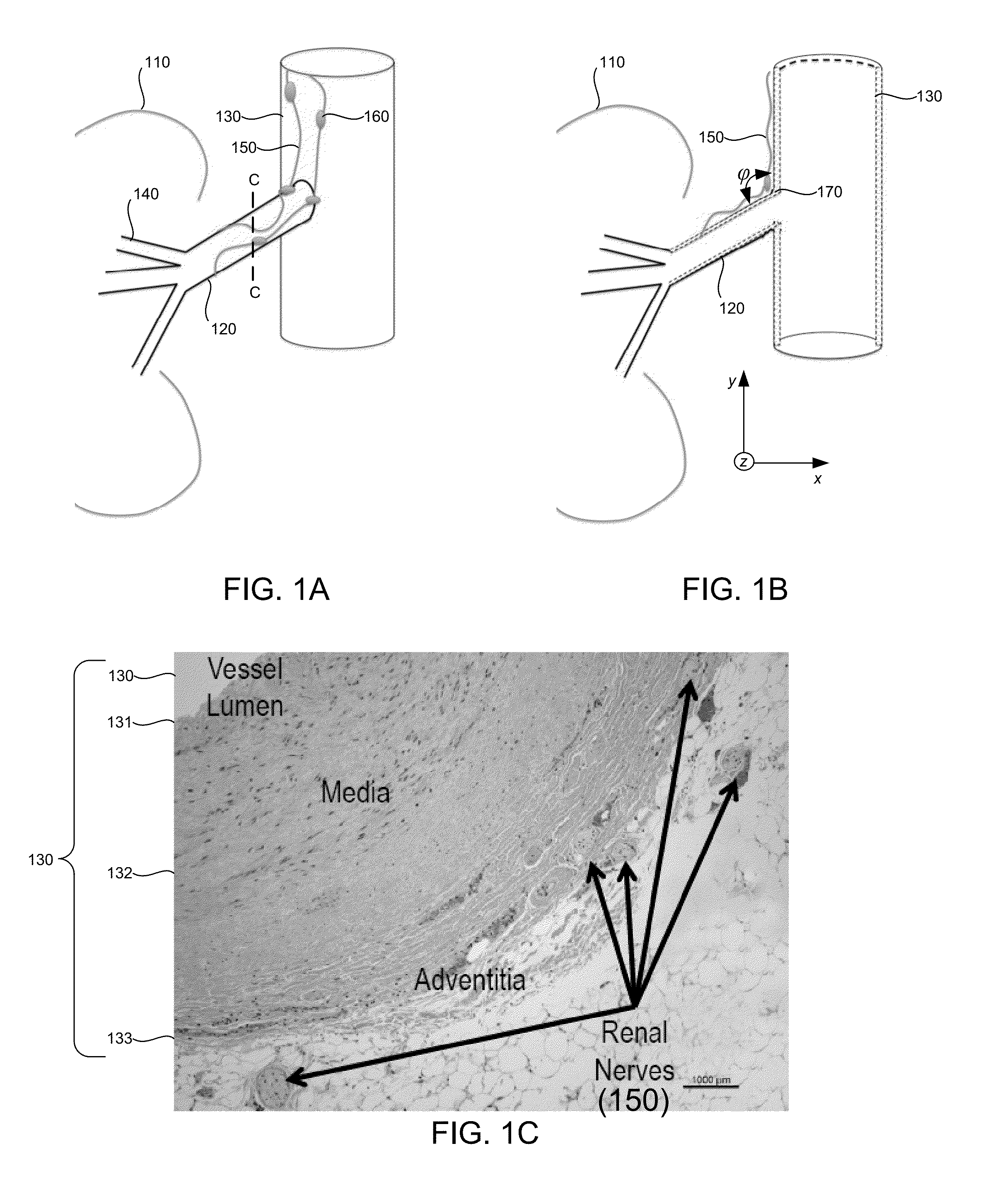 Systems for transcatheter ablation of adventitial or perivascular tissue while preserving medial and intimal vascular integrity through convergence of energy from one or more sources, and methods of making and using same