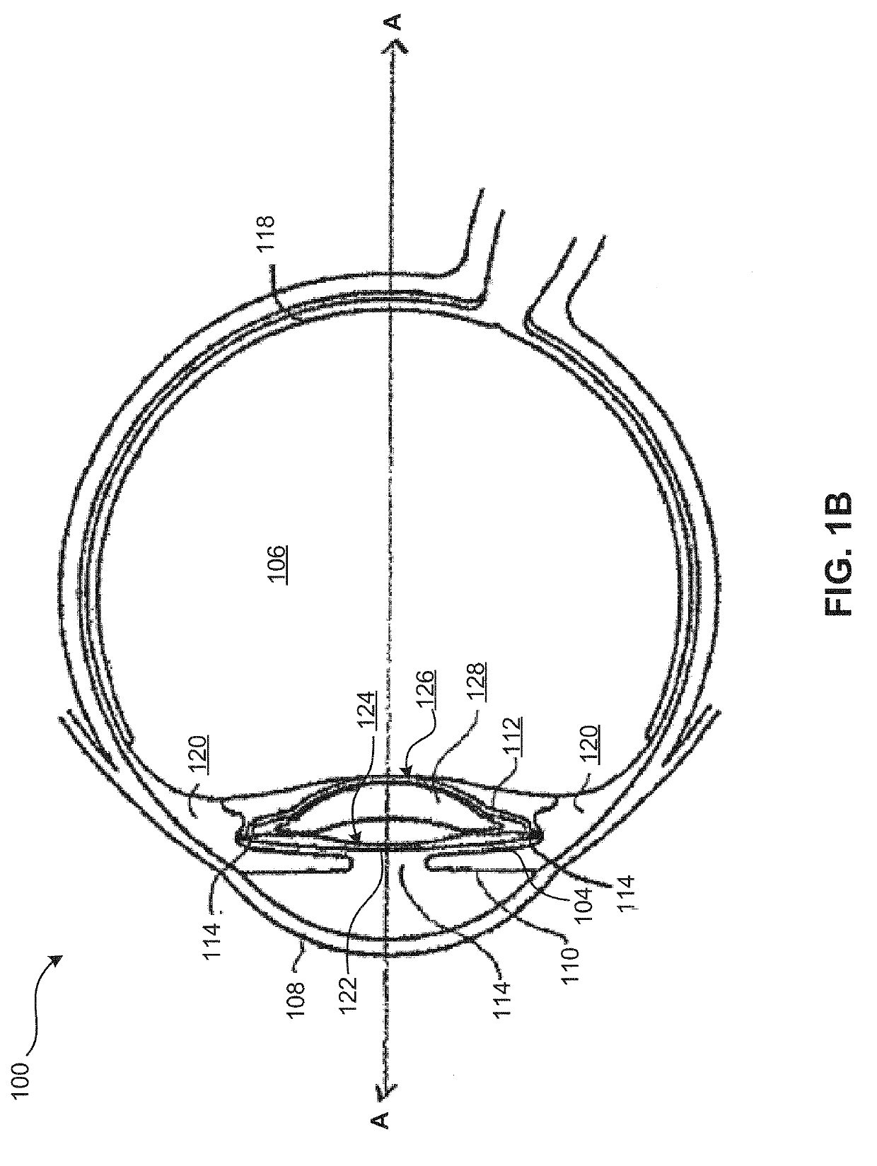 Lens oil having a narrow molecular weight distribution for intraocular lens devices