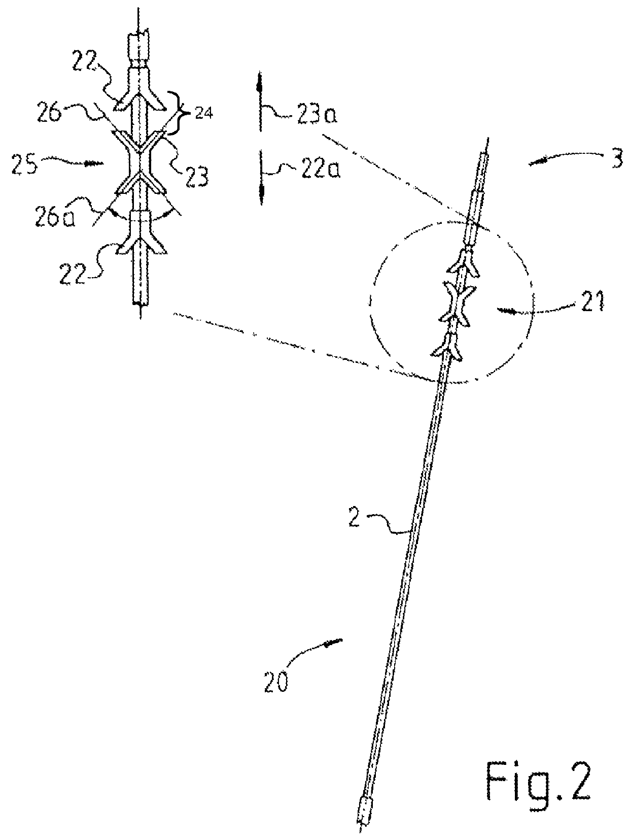 Sacral neuromodulator