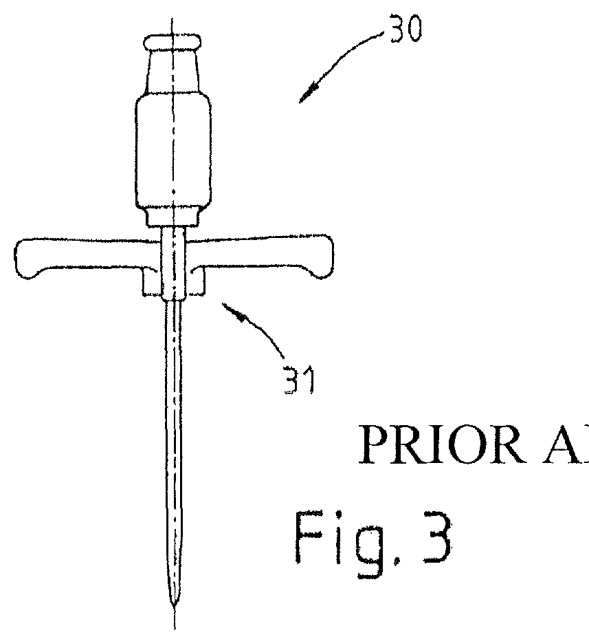 Sacral neuromodulator