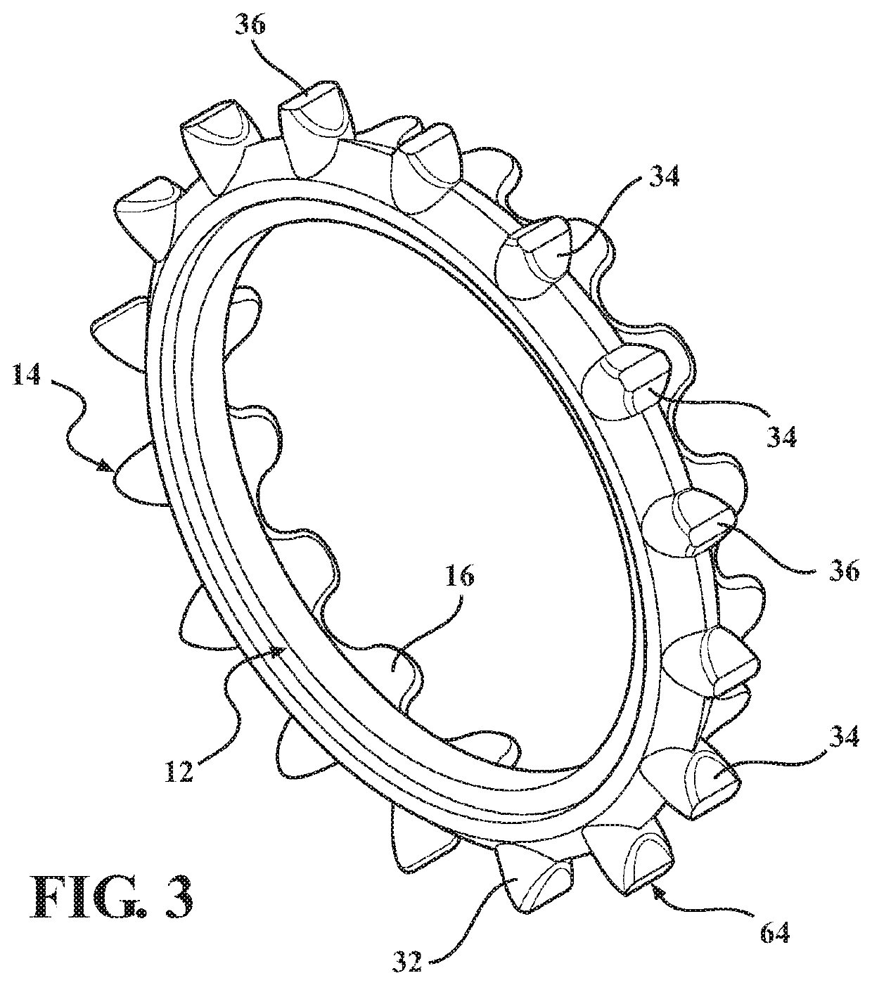 Furrow closing wheel assembly