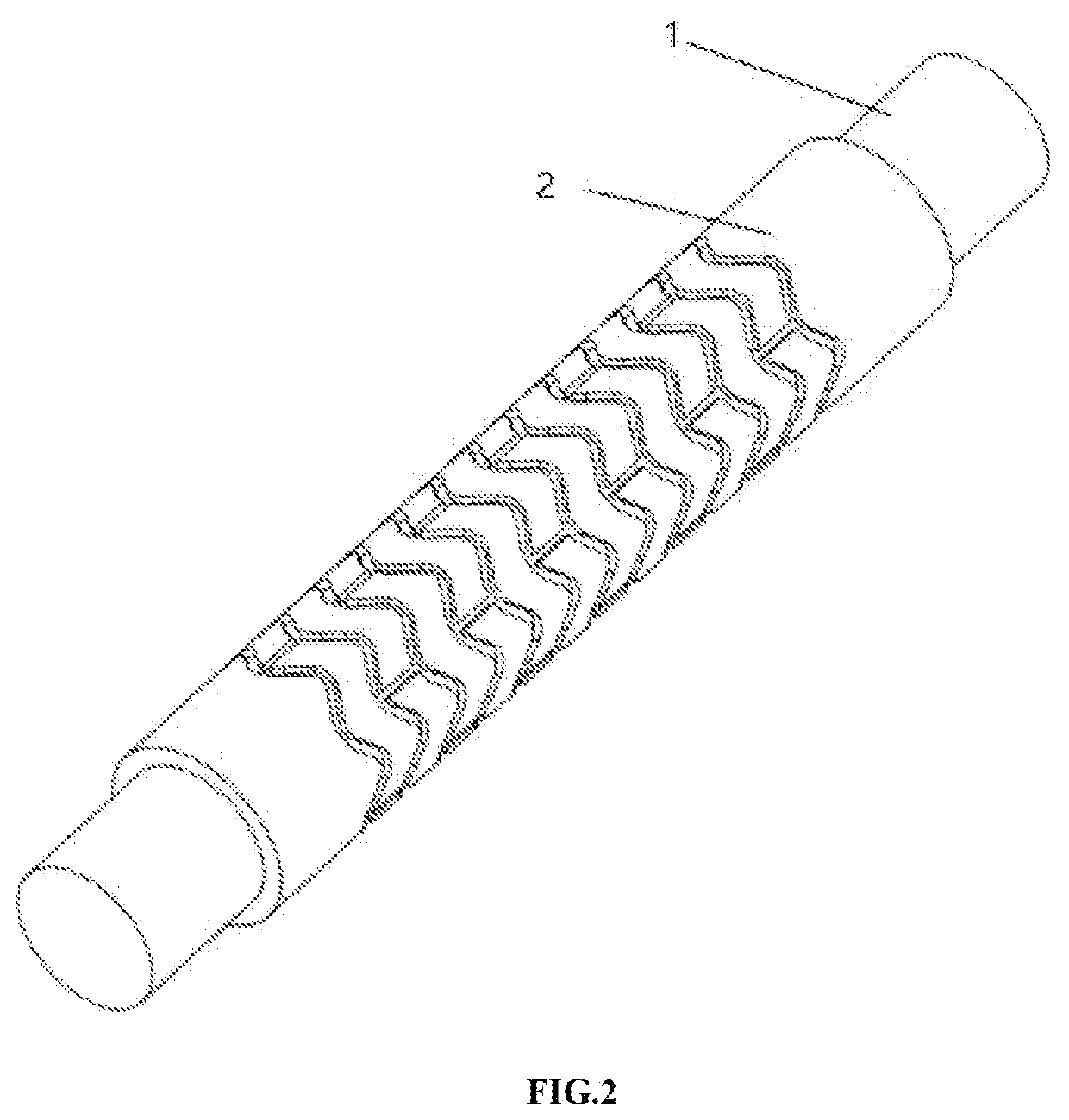 Injection Molding Method for Degradable Intravascular Stent with Flexible Mold Core Structure