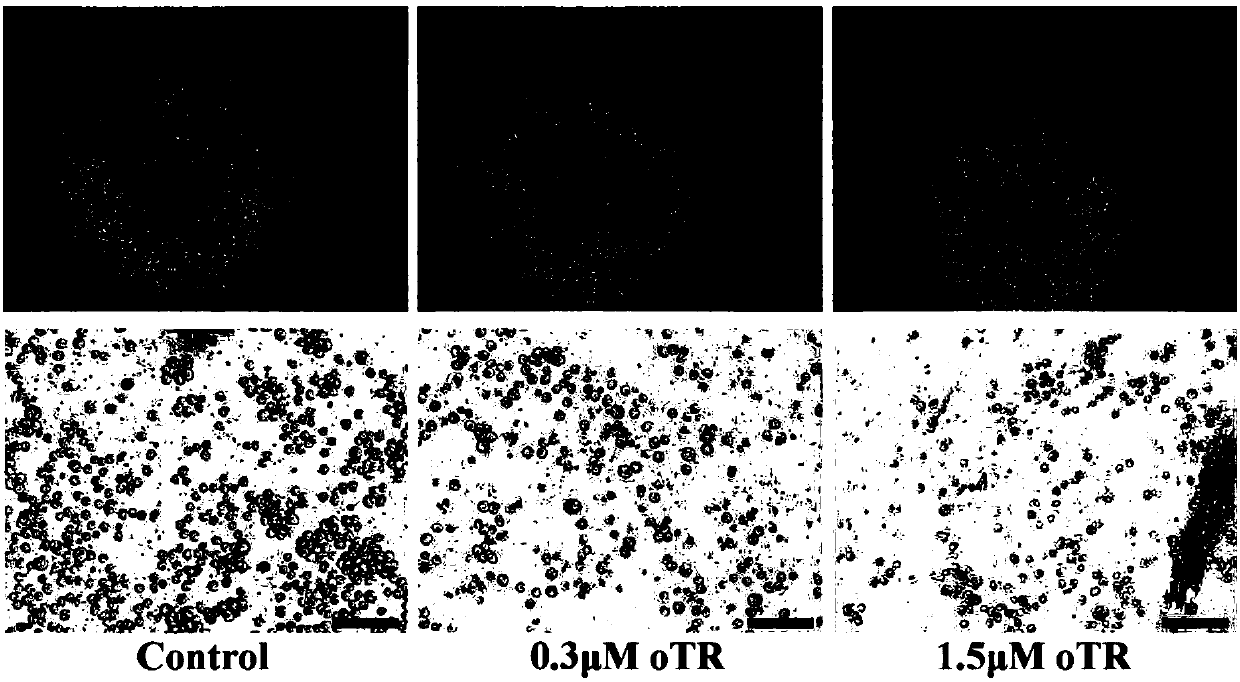 Application of cytokinin in causing of human leukemia cell apoptosis through nucleoside transporter