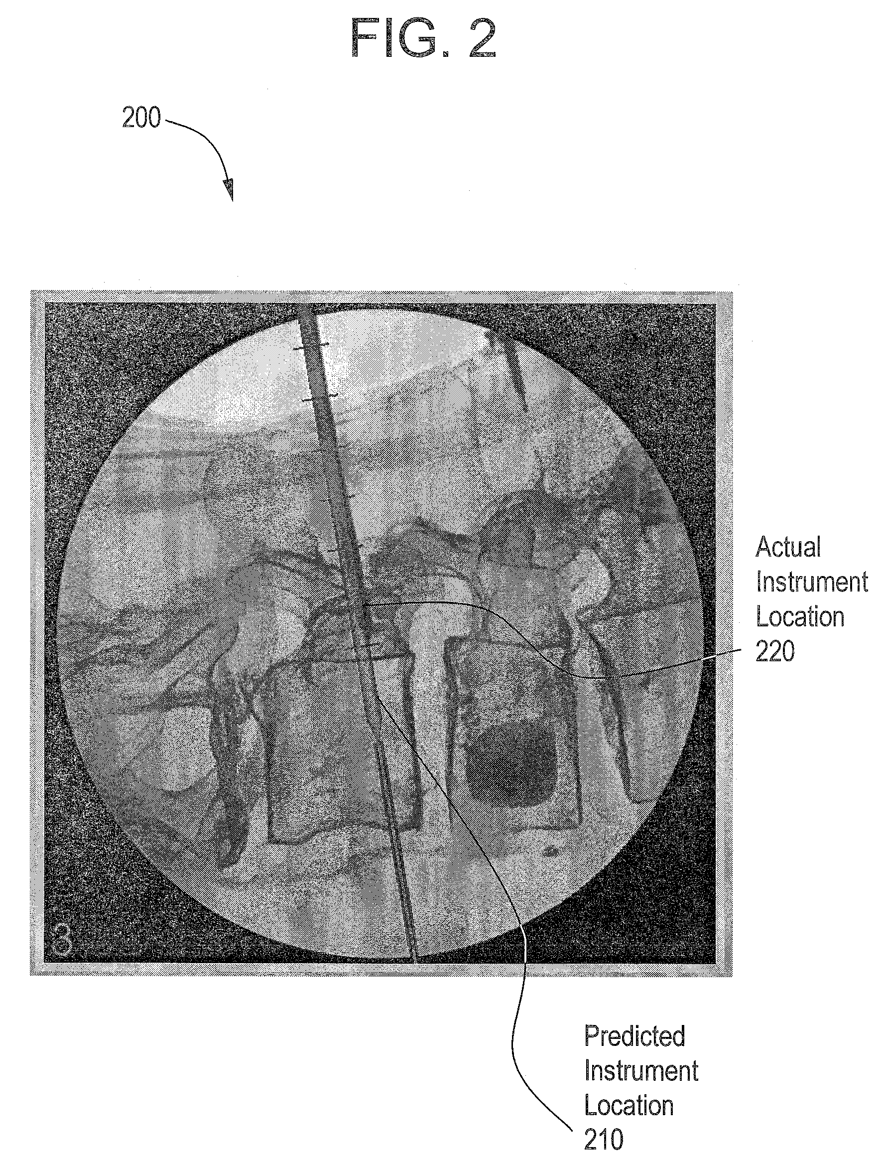 System and method for accuracy verification for image based surgical navigation