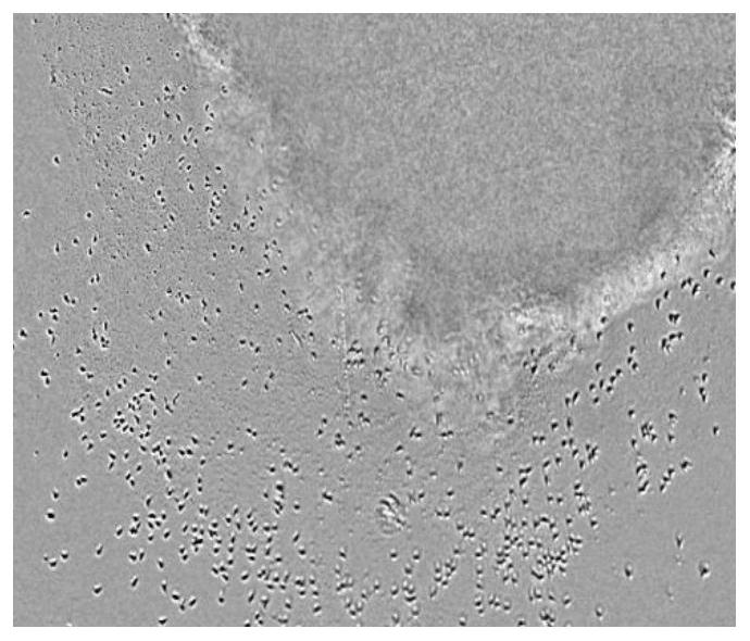 A method for isolation and induction of tumor-infiltrating T-lymphocytes suitable for malignant solid tumors