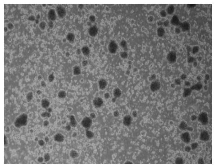 A method for isolation and induction of tumor-infiltrating T-lymphocytes suitable for malignant solid tumors