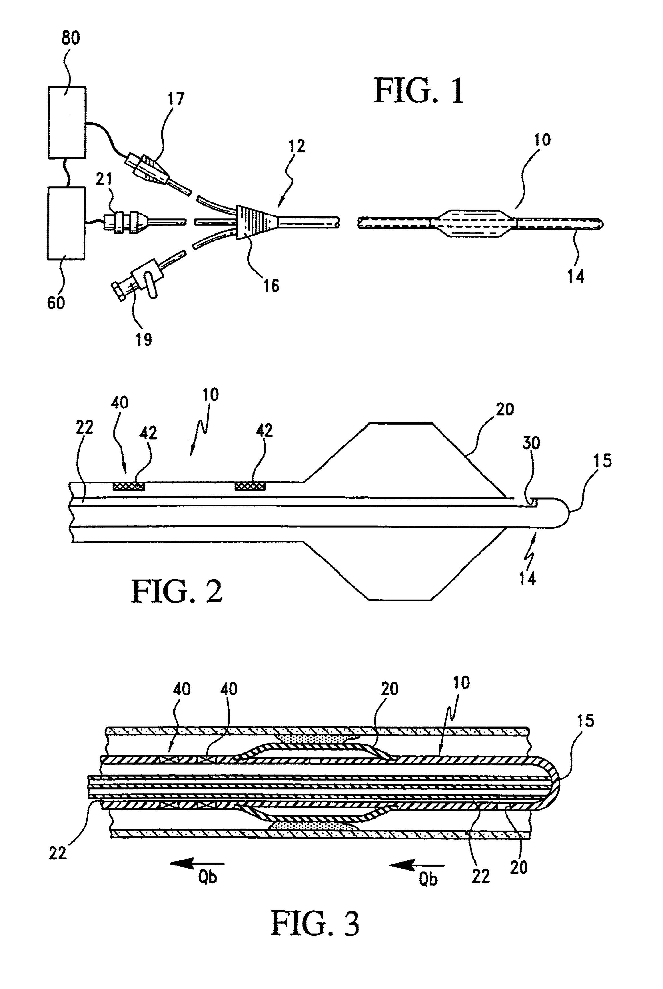 Method and apparatus for determining blood flow during a vascular corrective procedure
