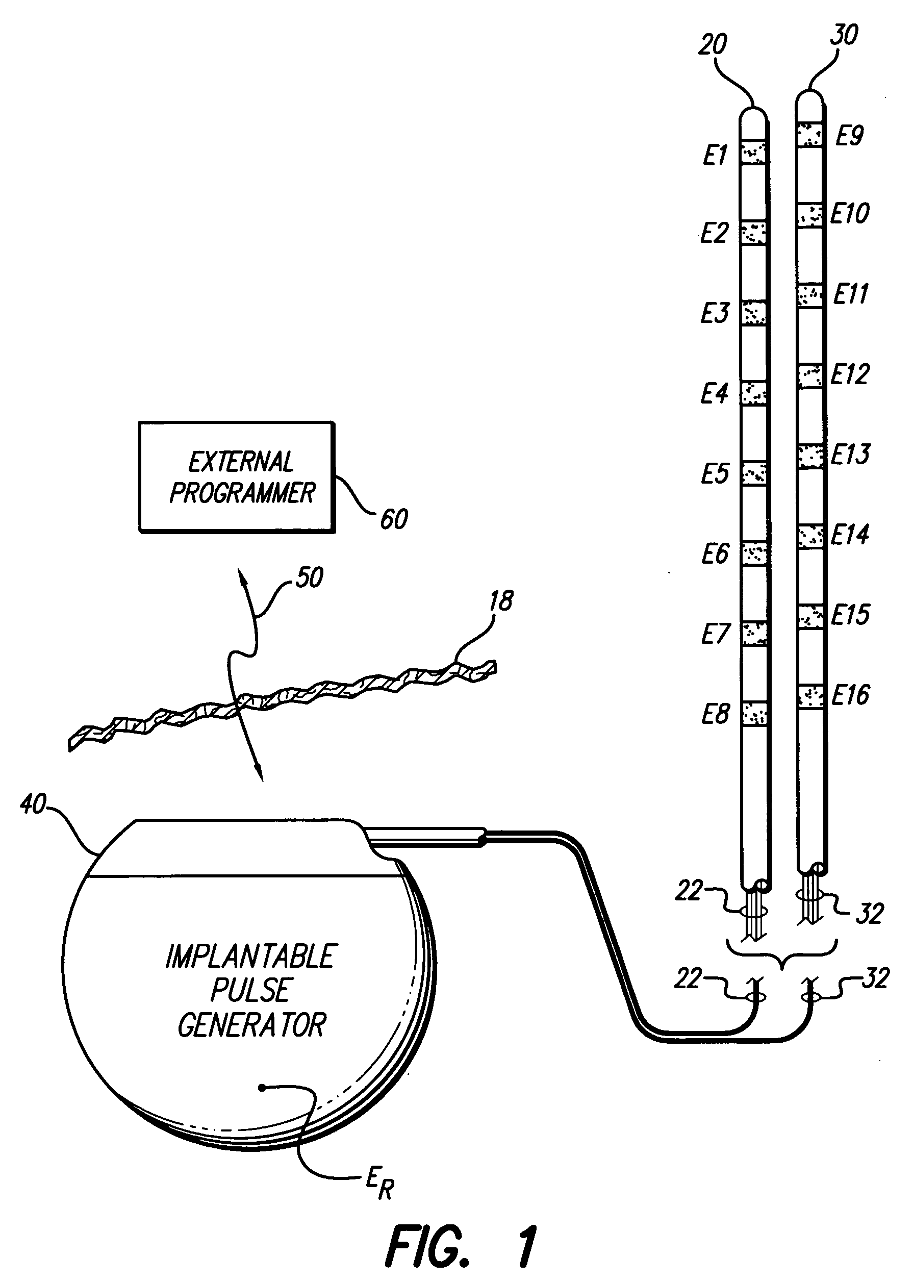 Apparatus and method for determining the relative position and orientation of neurostimulation leads