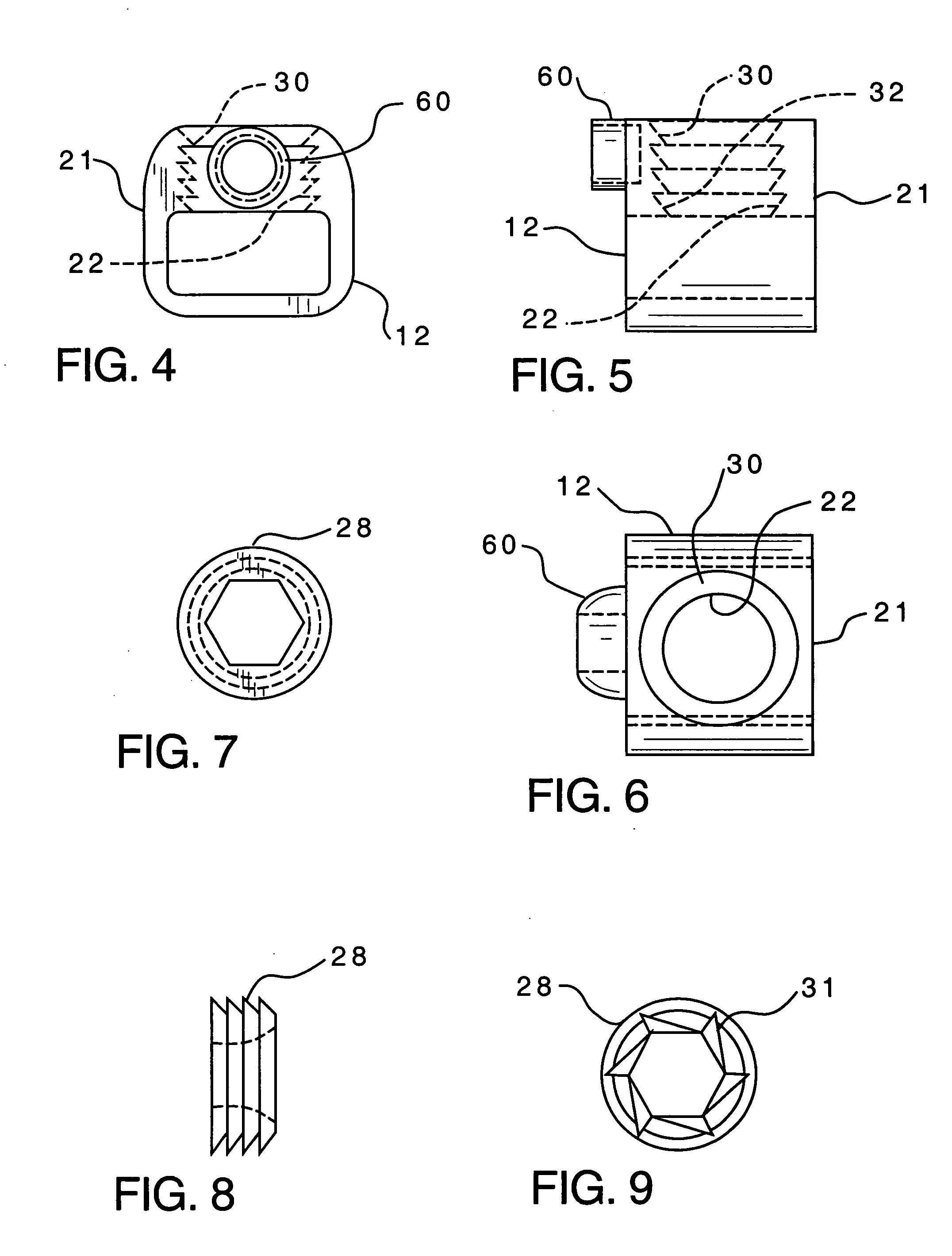 Spinal stabilization implant and method of application