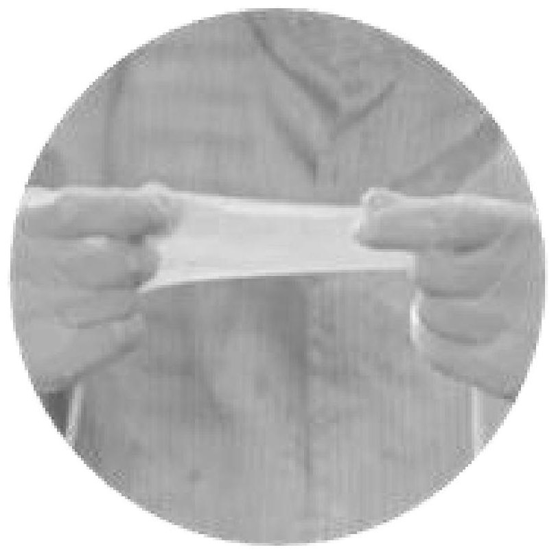 Preparation method and anti-adhesion film for preventing and treating sarcolemma adhesion