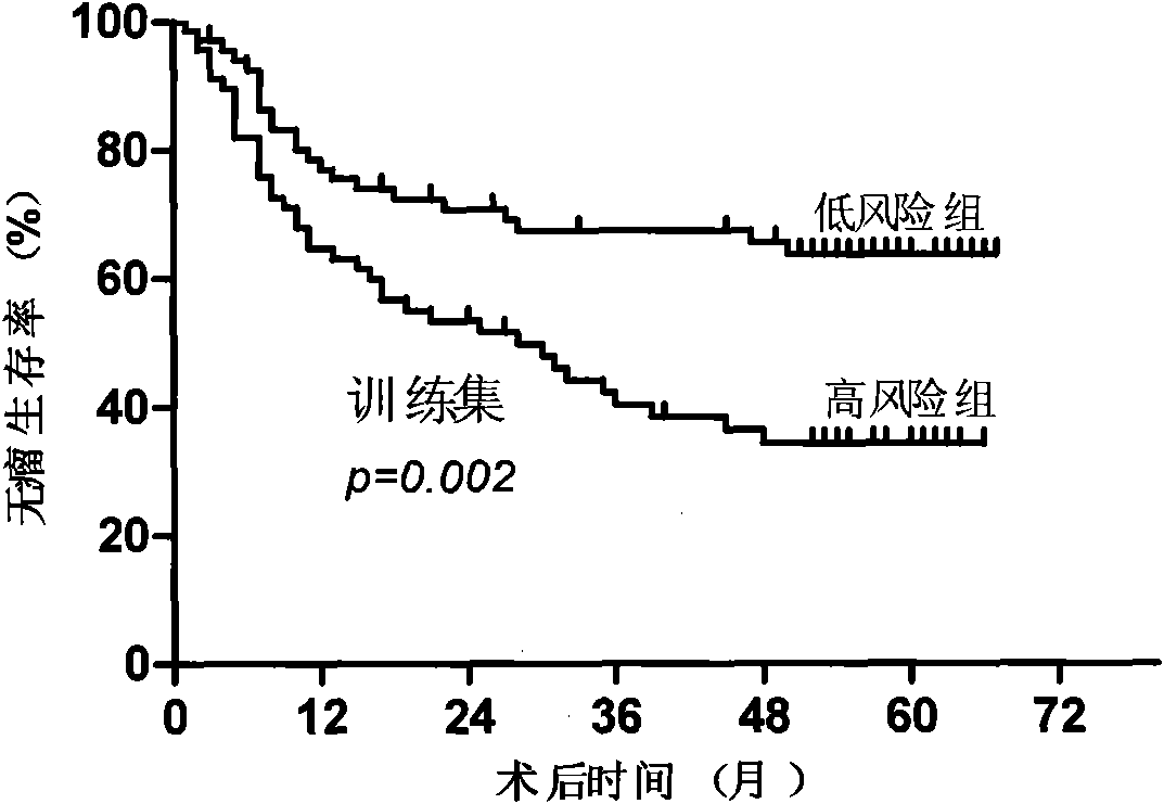 Gene chip of prediction of recurrence after hepatocellular carcinoma operation