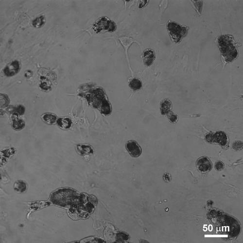 A method for improving the adipogenic differentiation efficiency of bone marrow mesenchymal stem cells