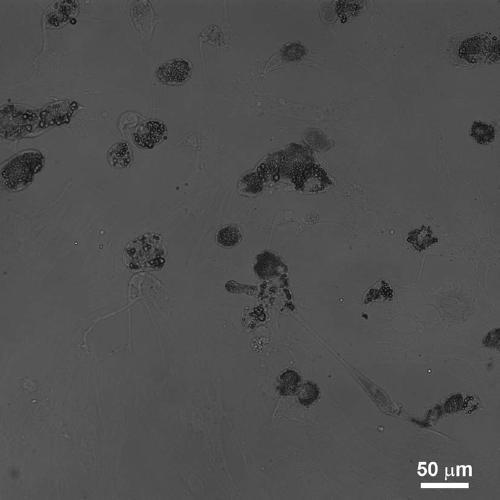 A method for improving the adipogenic differentiation efficiency of bone marrow mesenchymal stem cells