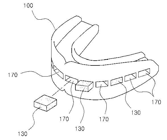 Dental pad for dentition malocclusion orthodontic treatment and use method thereof