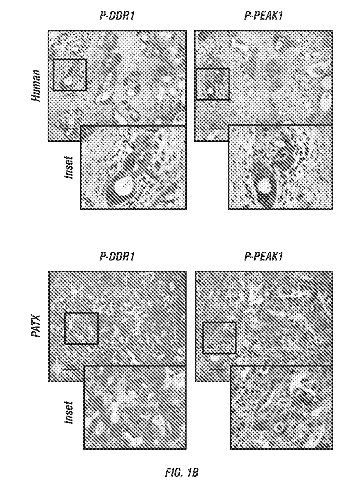 Small-molecule inhibitors targeting discoidin domain receptor 1 and uses thereof