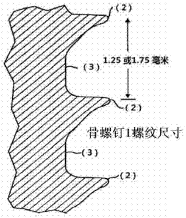 A kind of bone injury repair fixation device and preparation method thereof