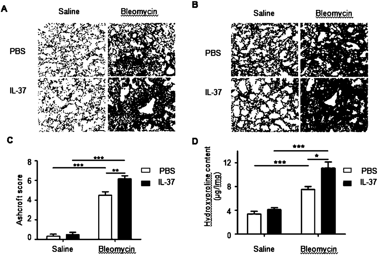 Application of interleukin-37 to controlling fibrosis related diseases