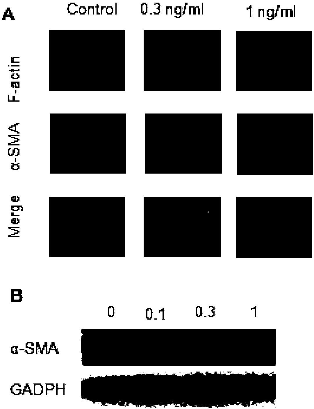 Application of interleukin-37 to controlling fibrosis related diseases