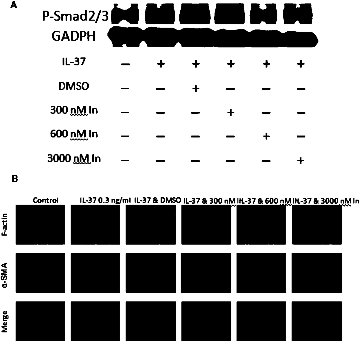 Application of interleukin-37 to controlling fibrosis related diseases